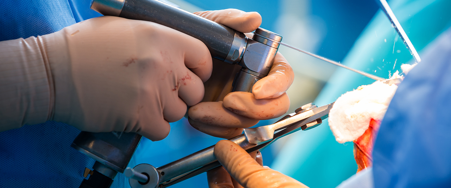 sequoia-surgical-pavilion-total-joint-replacement sequoia-surgical-pavilion-total-joint-replacement